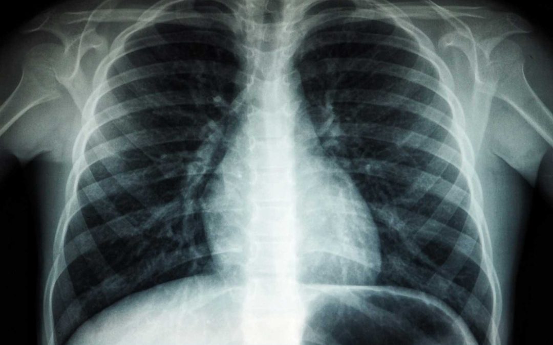 Understanding your scans